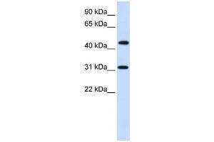 WB Suggested Anti-ZNF684 Antibody Titration:  0.