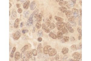 Immunohistochemistry (IHC) image for anti-Cullin 2 (CUL2) (AA 150-200) antibody (ABIN7448503)