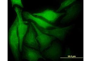 Immunofluorescence of monoclonal antibody to MAD2L1BP on HeLa cell. (MAD2L1BP antibody  (AA 1-274))