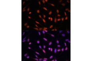 Immunofluorescence analysis of NIH/3T3 cells using Twist antibody (ABIN6128846, ABIN6149715, ABIN6149718 and ABIN6223153) at dilution of 1:100. (TWIST1 antibody  (AA 103-202))