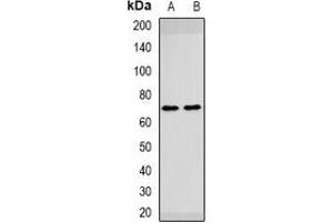 Western blot analysis of HAI-1 expression in mouse liver (A), rat brain (B) whole cell lysates. (SPINT1 antibody)