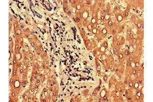 Immunohistochemistry of paraffin-embedded human liver tissue using ABIN7165933 at dilution of 1:100 (PPP1R3B antibody  (Regulatory Subunit 3B))