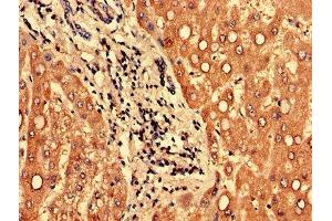 Immunohistochemistry of paraffin-embedded human liver tissue using ABIN7165933 at dilution of 1:100 (PPP1R3B antibody  (Regulatory Subunit 3B))
