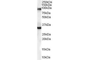 Image no. 1 for anti-LIM Domain Binding 3 (LDB3) (Internal Region) antibody (ABIN374603) (LIM Domain Binding 3 Protein antibody  (Internal Region))