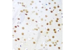 Immunohistochemistry of paraffin-embedded mouse brain using UNG antibody (ABIN6133476, ABIN6149934, ABIN6149936 and ABIN6216305) at dilution of 1:100 (40x lens). (UNG antibody  (AA 1-313))