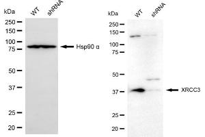anti-X-Ray Repair Complementing Defective Repair in Chinese Hamster Cells 3 (XRCC3) antibody