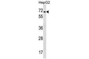 CACNB1 Antibody (C-term) western blot analysis in HepG2 cell line lysates (35µg/lane). (CACNB1 antibody  (C-Term))