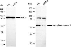 Western blotting analysis using arginyltransferase 1 antibody (ABIN7797649). (Recombinant ATE1 antibody)