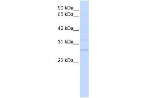 TMEM126B antibody used at 1 ug/ml to detect target protein. (TMEM126B antibody  (N-Term))