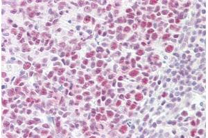 Anti-EP300 / p300 antibody IHC staining of human tonsil.