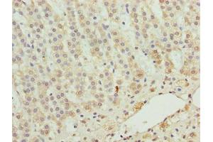 Immunohistochemistry of paraffin-embedded human adrenal gland tissue using ABIN7176171 at dilution of 1:100 (ZNF226 antibody  (AA 1-94))