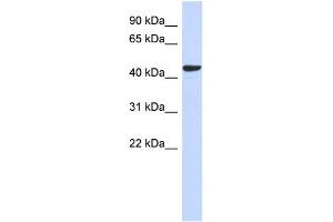 WB Suggested Anti-SGMS2 Antibody Titration: 0. (Sphingomyelin Synthase 2 antibody  (N-Term))