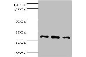 Western blot All lanes: NNMT antibody at 2. (NNMT antibody  (AA 1-264))