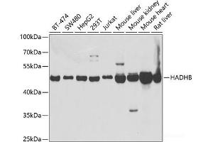 Western blot analysis of extracts of various cell lines using HADHB Polyclonal Antibody at dilution of 1:1000. (HADHB antibody)