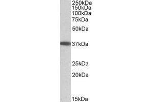 Western Blotting (WB) image for anti-Monoacylglycerol O-Acyltransferase 2 (MOGAT2) (Internal Region) antibody (ABIN2464724)