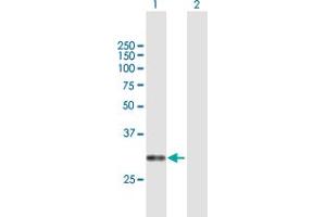 Western Blot analysis of CACNG6 expression in transfected 293T cell line by CACNG6 MaxPab polyclonal antibody. (CACNG6 antibody  (AA 1-260))