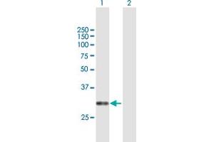 Western Blot analysis of CACNG6 expression in transfected 293T cell line by CACNG6 MaxPab polyclonal antibody.