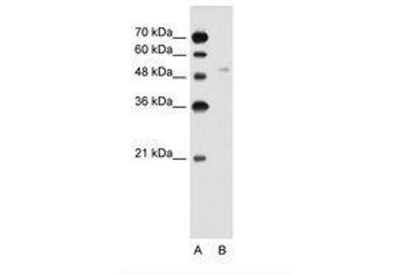 SLC2A6 Antikörper  (AA 351-400)