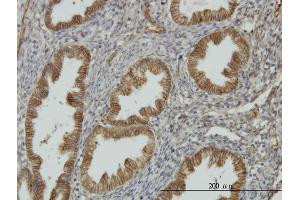 Immunoperoxidase of monoclonal antibody to NDRG1 on formalin-fixed paraffin-embedded human endometrium. (NDRG1 antibody  (AA 1-394))