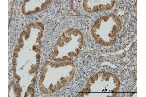 Immunoperoxidase of monoclonal antibody to NDRG1 on formalin-fixed paraffin-embedded human endometrium. (NDRG1 antibody  (AA 1-394))