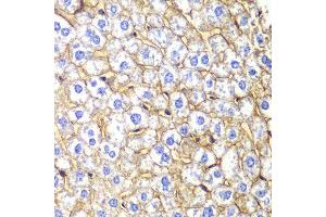 Immunohistochemistry of paraffin-embedded mouse liver using CDH2 antibody at dilution of 1:100 (400x lens). (N-Cadherin antibody)