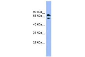Image no. 1 for anti-Pantothenate Kinase 4 (PANK4) (AA 359-408) antibody (ABIN6744130) (PANK4 antibody  (AA 359-408))