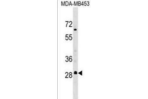 RH3 Antibody (C-term) (ABIN1536881 and ABIN2849415) western blot analysis in MDA-M cell line lysates (35 μg/lane).