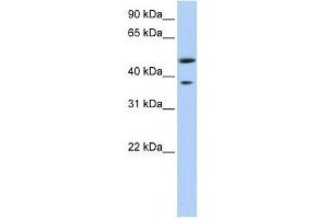MAGEA3 antibody used at 1 ug/ml to detect target protein.