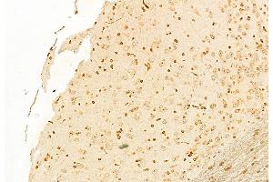 ABIN6262026 and ABIN6278470 at 1/100 staining Mouse brain tissue by IHC-P. (GNRH1 antibody  (Internal Region))