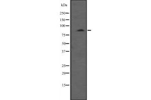 Western blot analysis of MYLK3 expression in HepG2 whole cell lysate ;;,The lane on the left is treated with the antigen-specific peptide.
