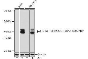 Western blot analysis of extracts of various cell lines, using Phospho-ERK1-T202/Y204 + ERK2-T185/Y187 Rabbit mAb (ABIN7268623) at 1:1000 dilution. (ERK1 antibody  (pThr185, pThr202, pThr204, pTyr187))