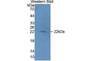 Detection of Recombinant HIBCH, Mouse using Polyclonal Antibody to 3-Hydroxyisobutyryl Coenzyme A Hydrolase (HIBCH) (HIBCH antibody  (AA 1-170))
