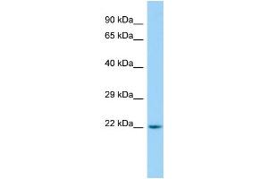 WB Suggested Anti-ARL15 Antibody Titration: 1. (ARL15 antibody  (C-Term))