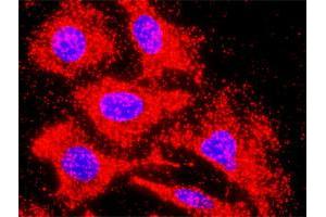 Proximity Ligation Analysis of protein-protein interactions between INHBB and ACVR1C. (INHBB antibody  (AA 1-407))