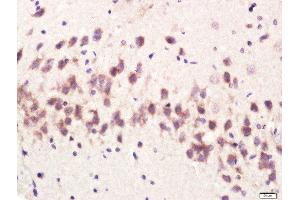 Paraformaldehyde-fixed, paraffin embedded rat brain tissue, Antigen retrieval by boiling in sodium citrate buffer(pH6) for 15min, Block endogenous peroxidase by 3% hydrogen peroxide for 30 minutes, Blocking buffer (normal goat serum) at 37°C for 20min, Antibody incubation with Rabbit Anti-CPLX1 Polyclonal Antibody, Unconjugated  at 1:400 overnight at 4°C, followed by a conjugated secondary and DAB staining (Complexin 1 antibody  (AA 31-100))