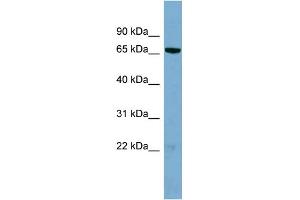 WB Suggested Anti-HP1BP3 Antibody Titration: 0. (HP1BP3 antibody  (N-Term))