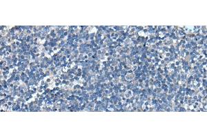 Immunohistochemistry of paraffin-embedded Human tonsil tissue using UFC1 Polyclonal Antibody at dilution of 1:50(x200) (UFC1 antibody)