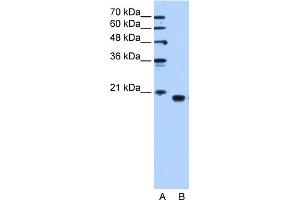 PEBP1 antibody used at 1.