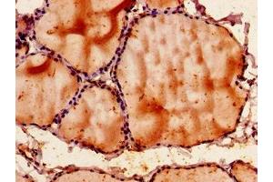 Immunohistochemistry of paraffin-embedded human thyroid tissue using ABIN7170408 at dilution of 1:100 (SNX9 antibody  (AA 85-200))