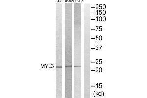 Western Blotting (WB) image for anti-Myosin, Light Chain 3 (MYL3) (Internal Region) antibody (ABIN1852580) (MYL3/CMLC1 antibody  (Internal Region))