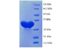 SDS-PAGE (SDS) image for Carbonic Anhydrase I (CA1) (AA 2-261), (full length) protein (His tag) (ABIN7479141)