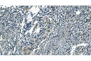 IHC analysis of PI-16/PI16 using anti-PI-16/PI16 antibody (ABIN7601074). (PI16 antibody  (AA 28-363))