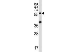 SOCS6 antibody western blot analysis in 293 lysate. (SOCS6 antibody  (AA 40-69))