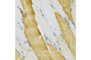 Immunohistochemistry of paraffin-embedded mouse skeletal muscle using PVALB Antibody (ABIN5971476) at dilution of 1/100 (40x lens). (PVALB antibody)