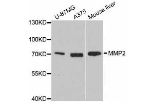 Western blot analysis of extracts of various cell lines, using MMP2 antibody. (MMP2 antibody)