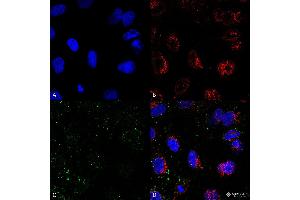 Immunocytochemistry/Immunofluorescence analysis on permeabilized HCT116 cells using Mouse Anti-HSP70 Monoclonal Antibody, Clone 1H11: FITC conjugate  showing faint cell membrane and intracellular staining. (HSP70 antibody  (Atto 594))