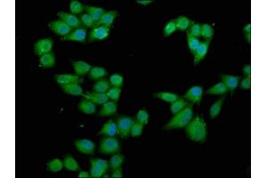Immunofluorescence staining of Hela cells with ABIN7168176 at 1:66, counter-stained with DAPI.