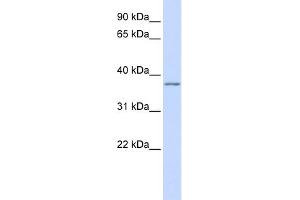 WB Suggested Anti-KCNAB2 Antibody Titration:  0. (KCNAB2 antibody  (Middle Region))