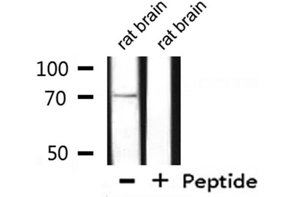 GUCY1B3 antibody  (N-Term)