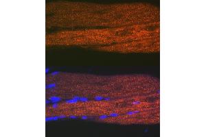 Immunofluorescence analysis of rat bone marrow cells using SERC/ Rabbit mAb (9639) at dilution of 1:100 (40x lens). (ATP2A1/SERCA1 antibody)